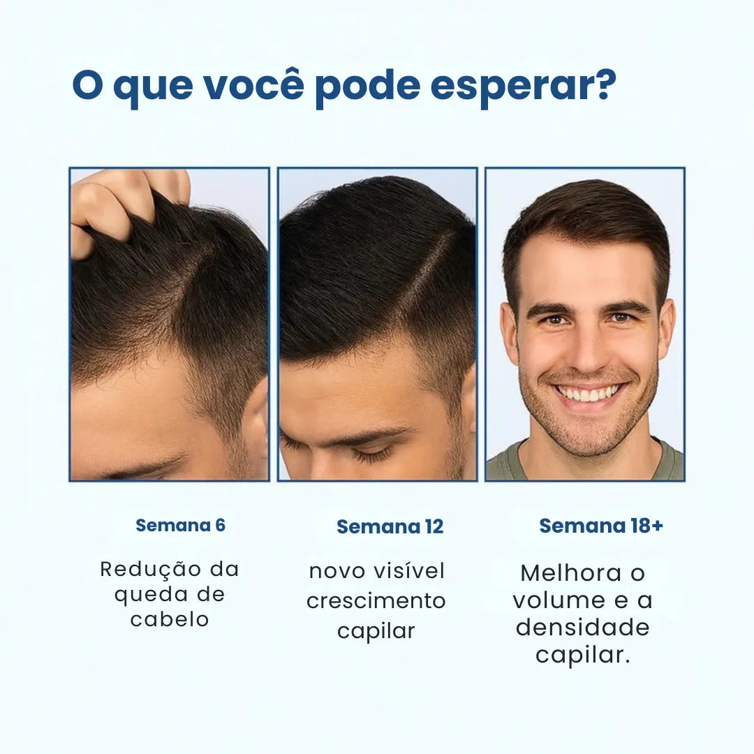 Daynava™ Roll-On para o Crescimento do Cabelo