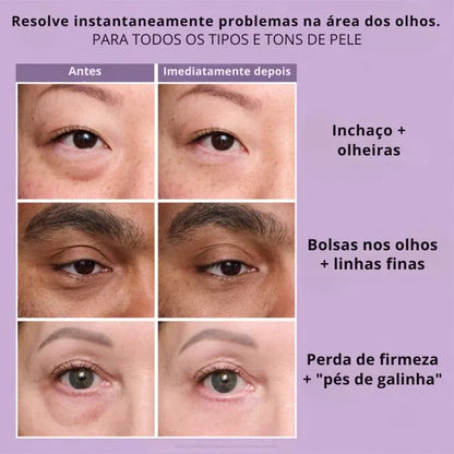 Daynava™ Lifting Instantâneo para os Olhos