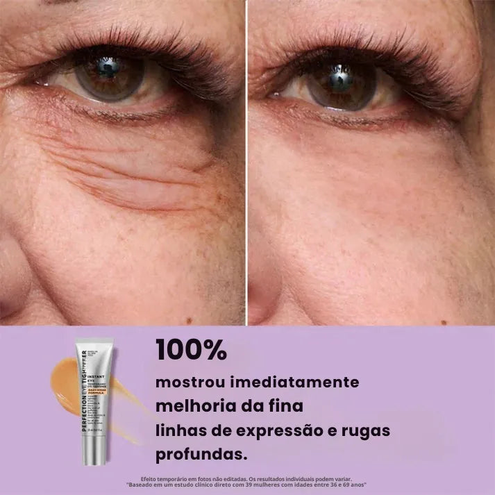 Daynava™ Lifting Instantâneo para os Olhos
