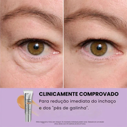 Daynava™ Lifting Instantâneo para os Olhos
